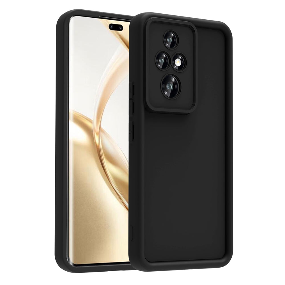 Honor 200 Pro Kılıf Kamera Korumalı Zore Ananas Kapak