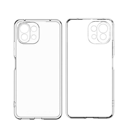 Xiaomi Mi 11 Kılıf Zore Kamera Korumalı Süper Silikon Kapak