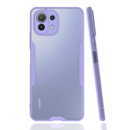 Xiaomi Mi 11 Lite Kılıf Zore Parfe Kapak