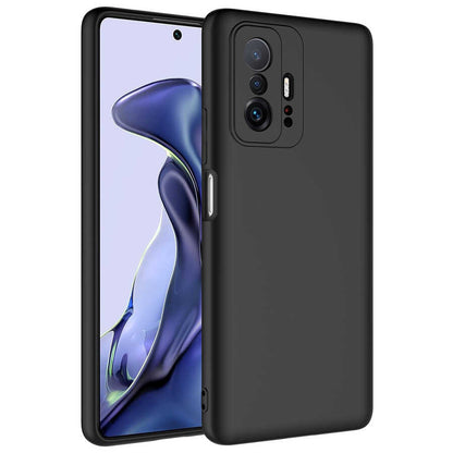 Xiaomi Mi 11T 5G Kılıf Zore Mara Lansman Kapak